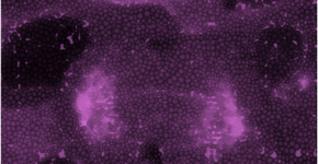 Journées d’étude Transition versus Bifurcation – Université de Montpellier, mars 2026.